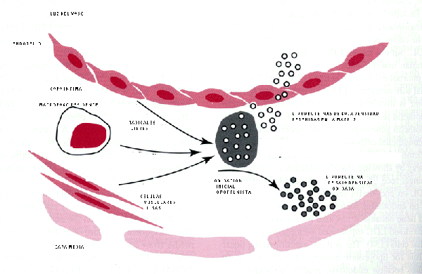 pasos de formación de placa de aterosclerosis